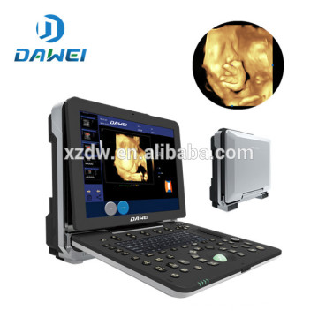 DW-C300 Ultrasonido portátil 4D doppler máquina de ultrasonido